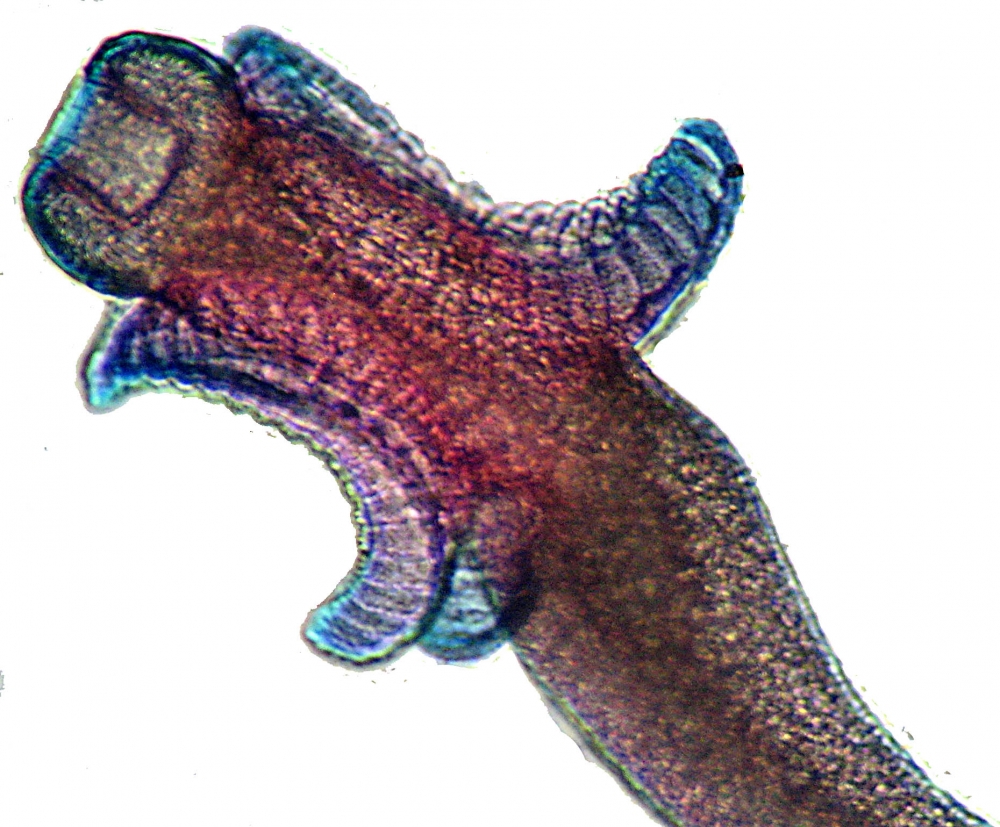 image of juvenile tapeworm