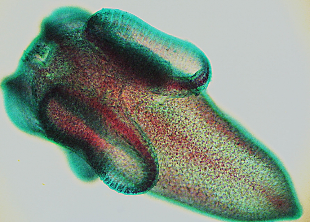 image of juvenile tapeworm