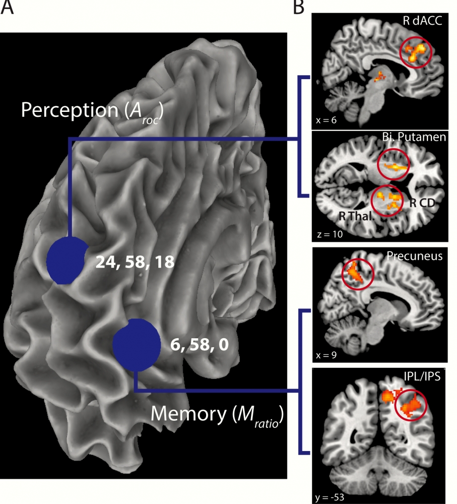 fMRI connectivity results