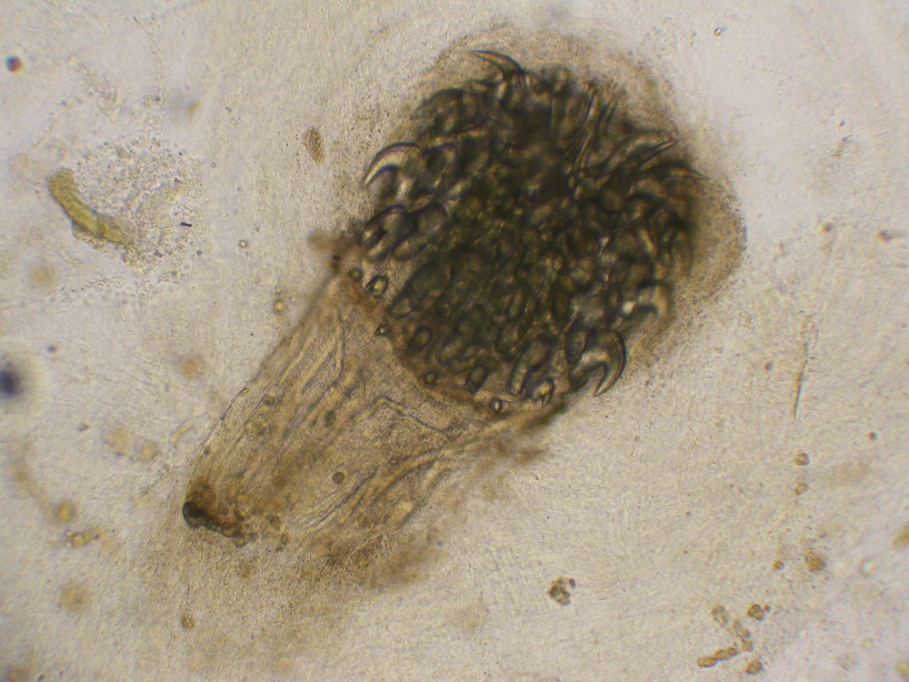 Microscope image of the head of a spiny headed worm