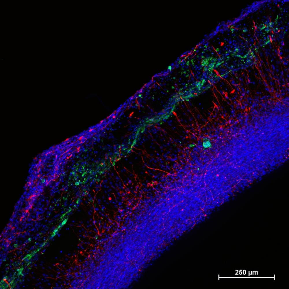 Neurotoxicity Predicted By Organoids >> Predicting Neural Toxicity The Ucsb Current Neurotoxicity Predicted By Organoids >> Predicting Neural Toxicity The Ucsb Current
