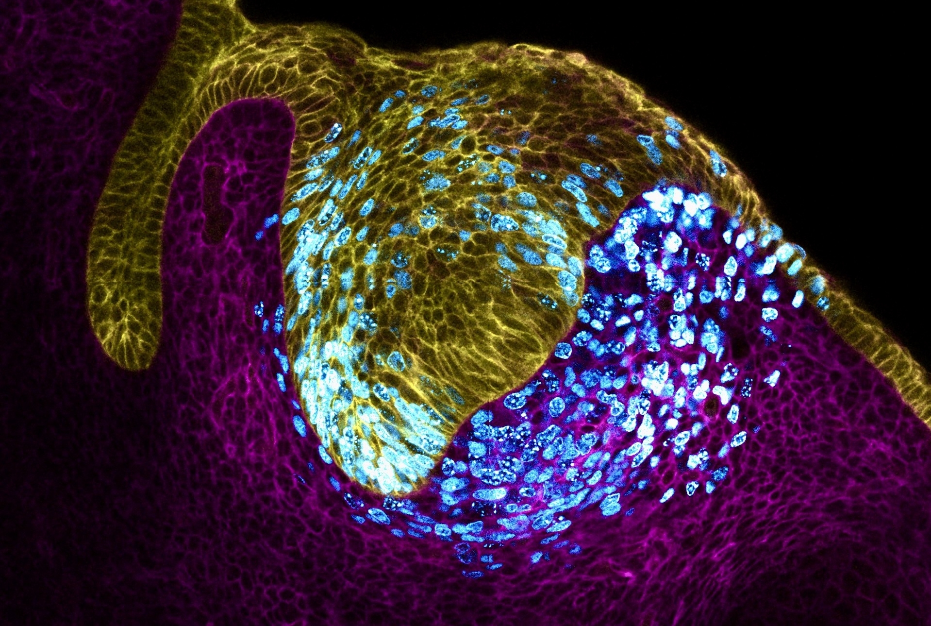 the cellular development of an embryonic tooth